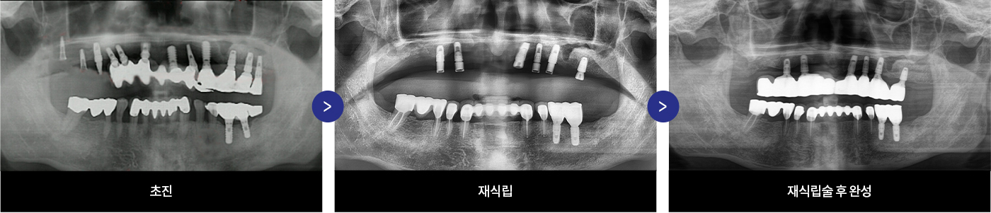 이미지명