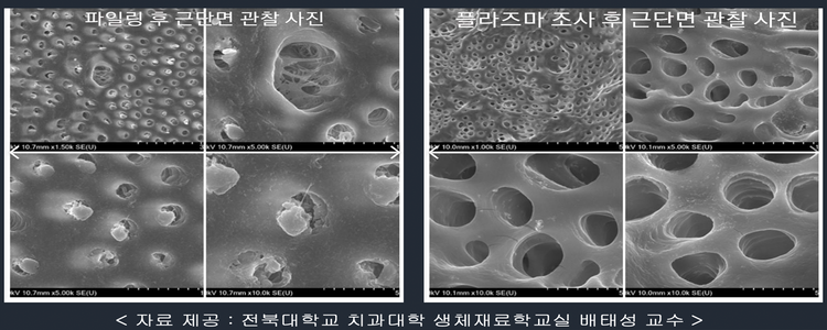 플라즈마 조사 전/후 근단면